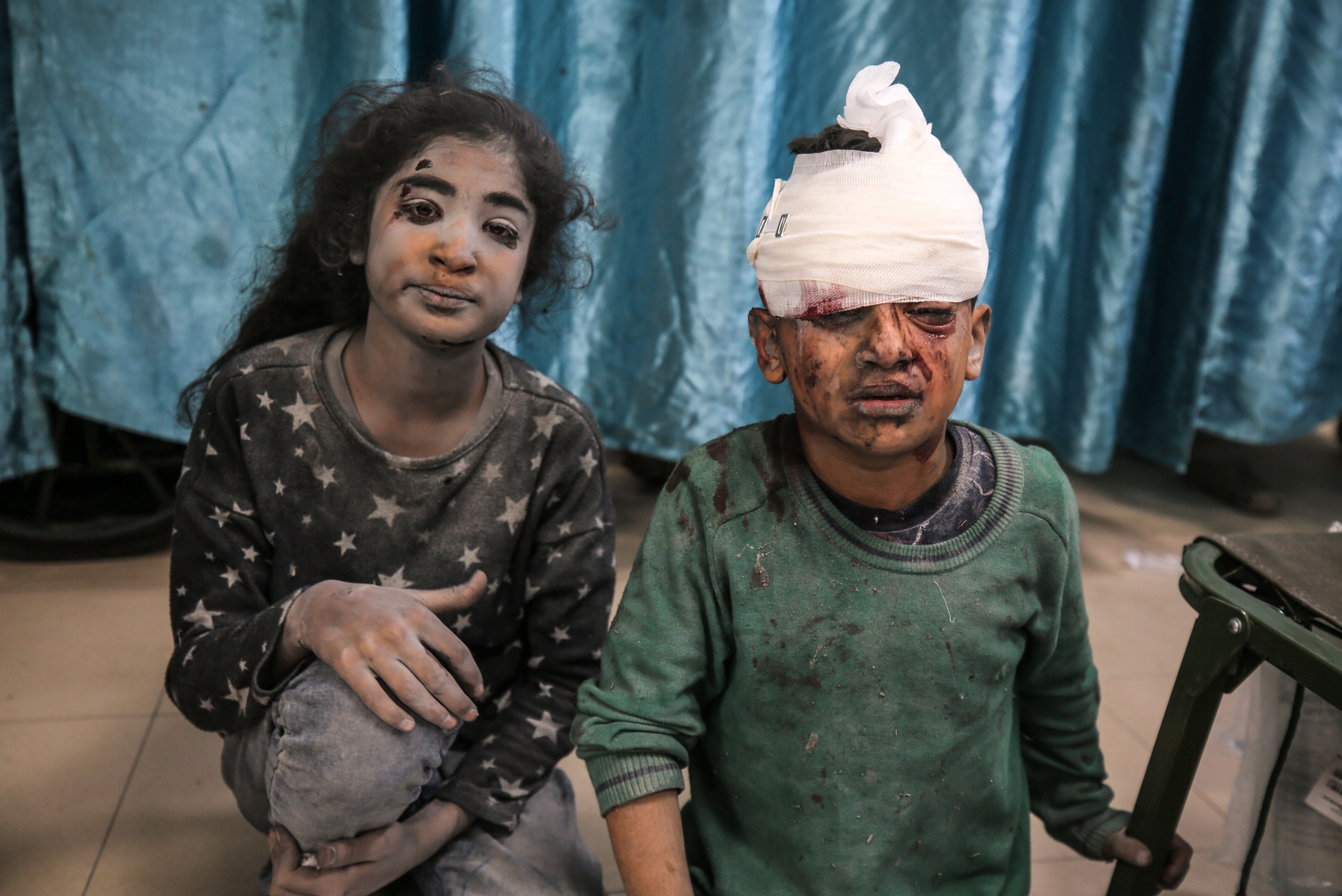 Zwei palästinensische Kinder wurden bei israelischen Luftangriffen verletzt
