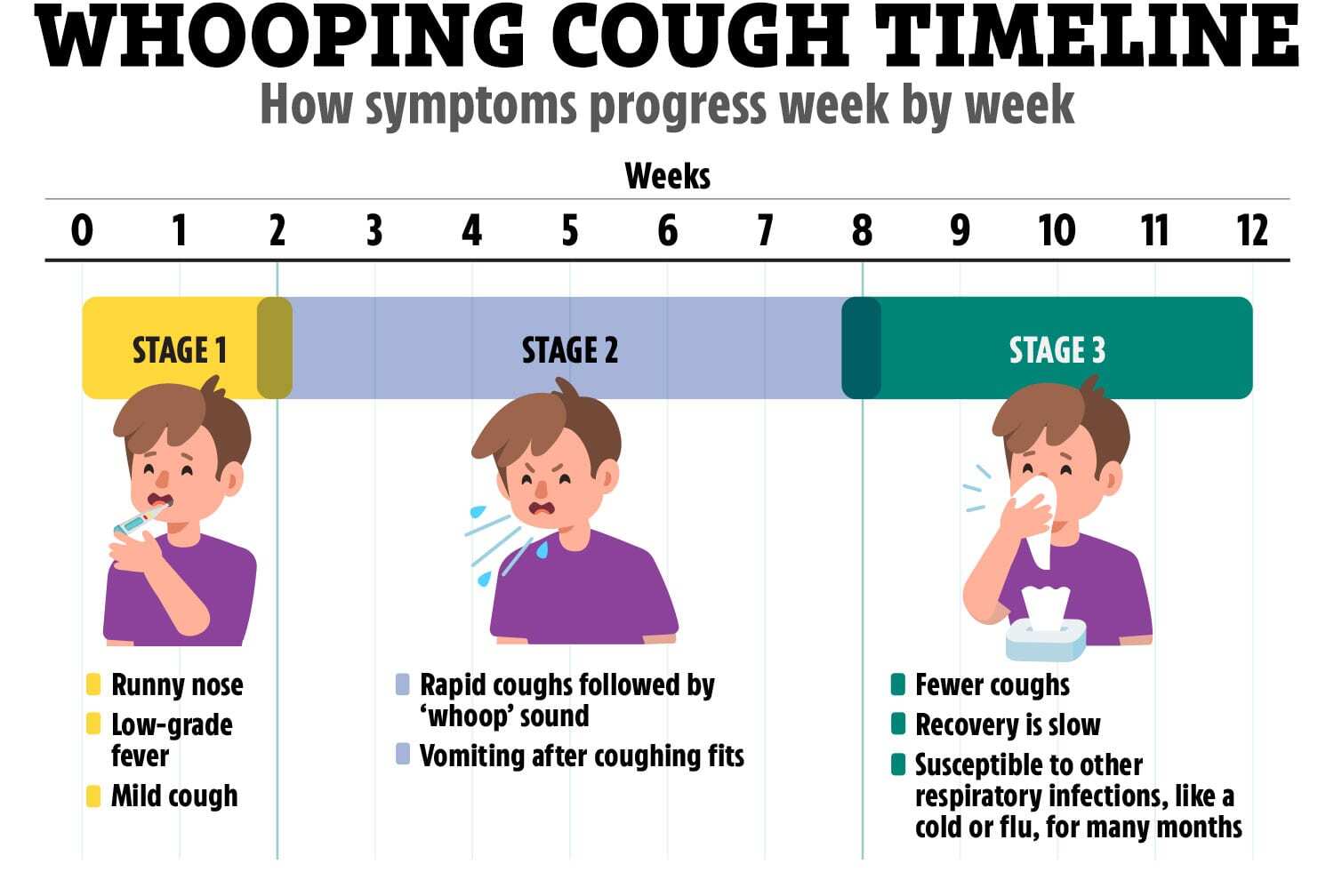 Keuchhusten kann mit erkältungsähnlichen Symptomen beginnen und sich dann zu einem krampfartigen Husten entwickeln